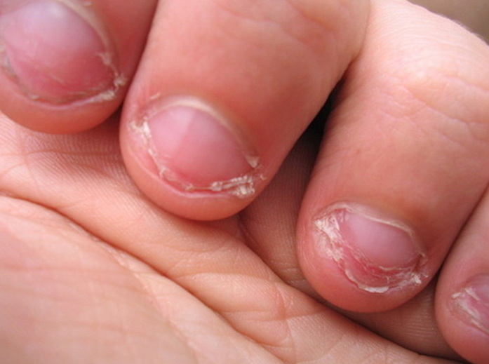 Причины по которым дети грызут ногти, опасно ли это и что с этим делать